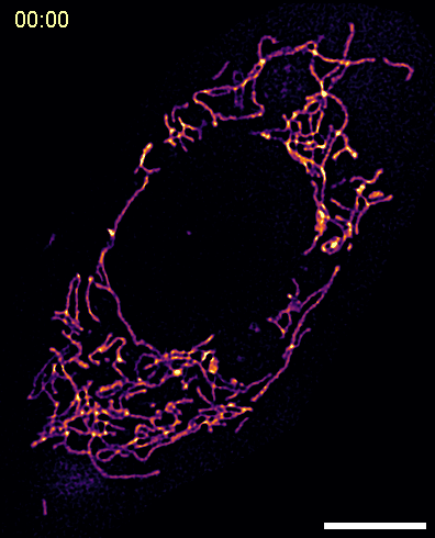Harapgifer skin mitochondria. Harapgifer skin mitochondria.